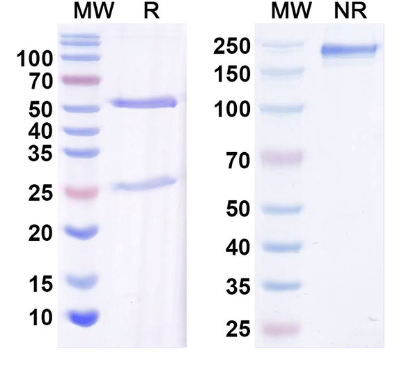 Anti-Corynephage omega DT/Diphtheria toxin Recombinant Monoclonal Antibody (DTD8) - SDS-PAGE