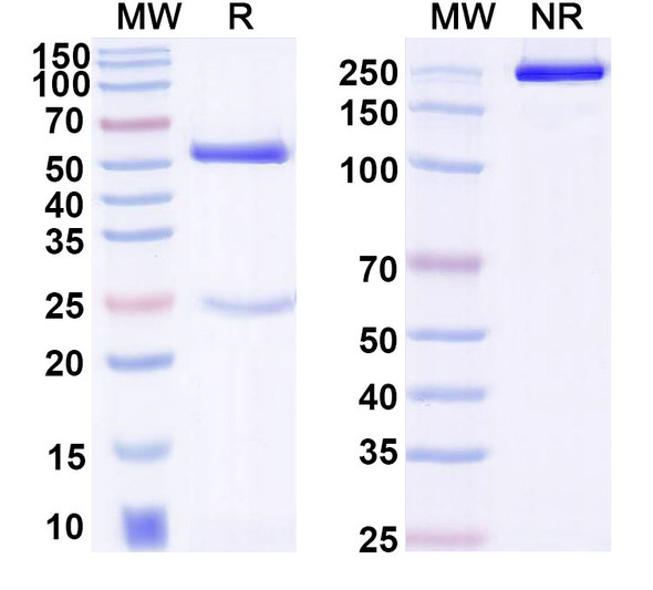 Anti-Corynephage omega DT/Diphtheria toxin Recombinant Monoclonal Antibody (DTD10) - SDS-PAGE
