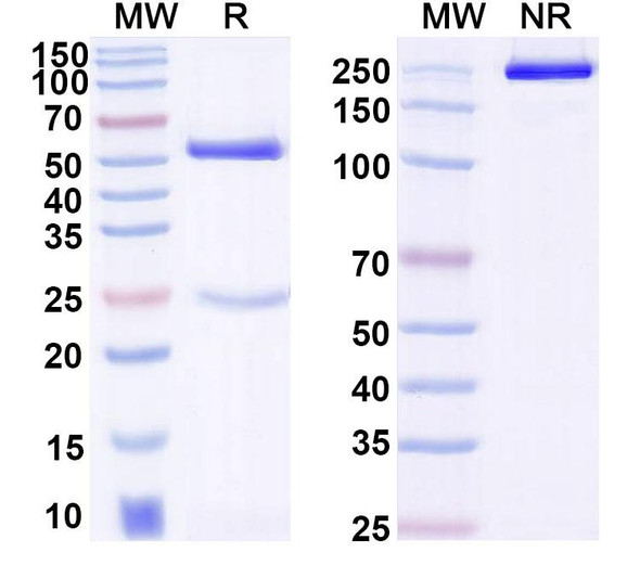 Anti-Human DLL4 Recombinant Monoclonal Antibody (21H3) - SDS-PAGE