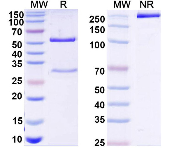Anti-Human ADAMTS5 Recombinant Monoclonal Antibody (7B4) - SDS-PAGE