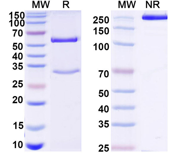 Anti-Human ADAMTS4 Recombinant Monoclonal Antibody (7C7) - SDS-PAGE