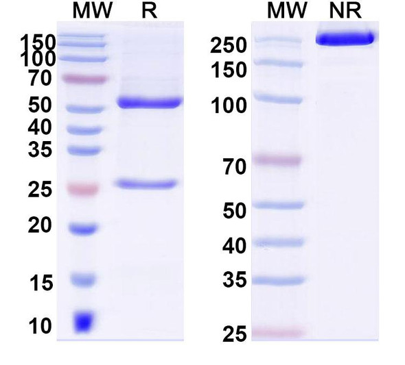 Anti-DNA Recombinant Monoclonal Antibody (P17.80) - SDS-PAGE