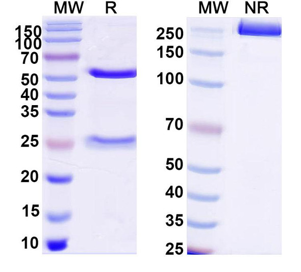 Anti-DNA Recombinant Monoclonal Antibody (202.105) - SDS-PAGE