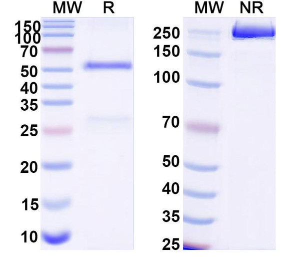 Anti-DNA Recombinant Monoclonal Antibody (165.33) - SDS-PAGE