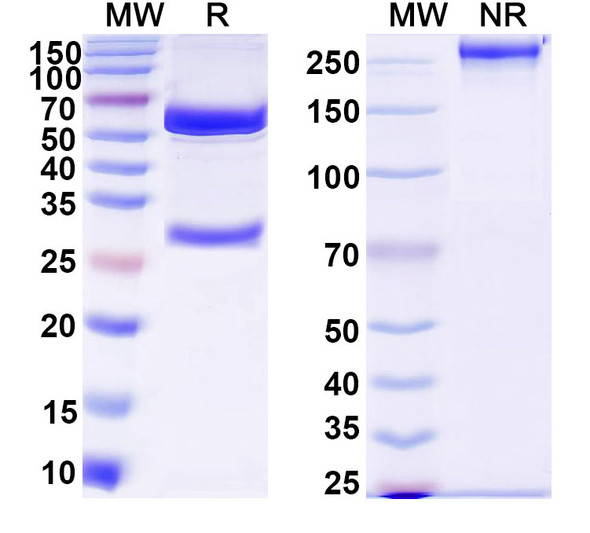 Anti-DNA Recombinant Monoclonal Antibody (17p.73) - SDS-PAGE