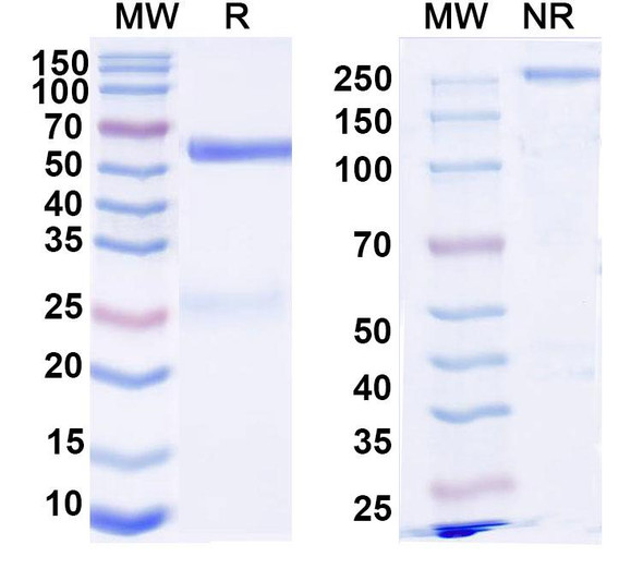Anti-DNA Recombinant Monoclonal Antibody (74.122) - SDS-PAGE