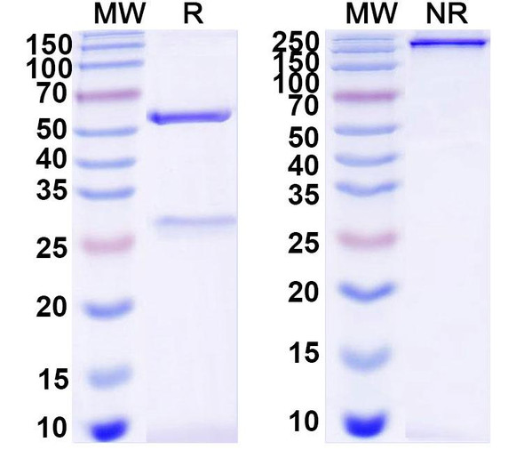 Anti-DNA Recombinant Monoclonal Antibody (2E3#) - SDS-PAGE