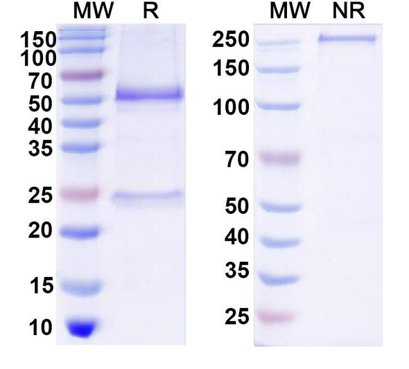 Anti-DNA Recombinant Monoclonal Antibody (DNA9) - SDS-PAGE