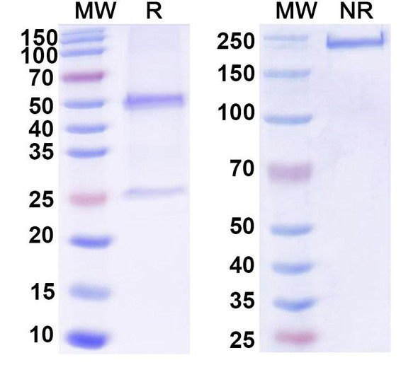 Anti-DNA Recombinant Monoclonal Antibody (BXW-16) - SDS-PAGE