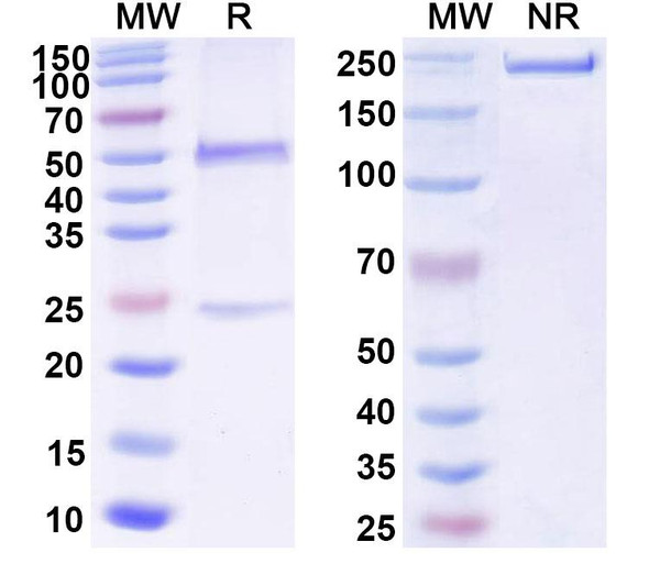 Anti-DNA Recombinant Monoclonal Antibody (BKV1) - SDS-PAGE