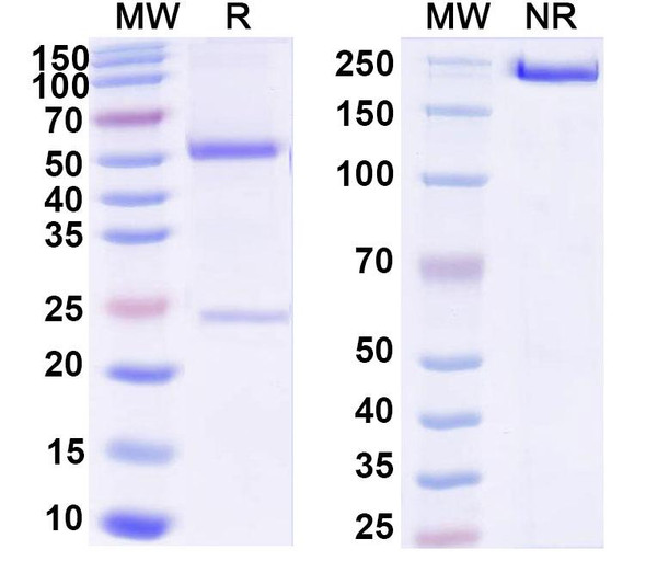 Anti-DNA Recombinant Monoclonal Antibody (H7) - SDS-PAGE