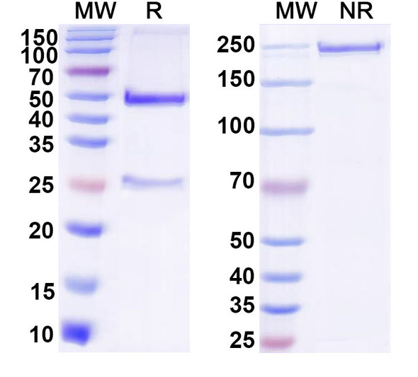Anti-DNA Recombinant Monoclonal Antibody (F-423) - SDS-PAGE