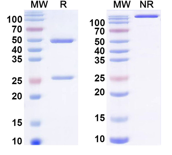 Anti-DNA Recombinant Monoclonal Antibody (9F11) - SDS-PAGE