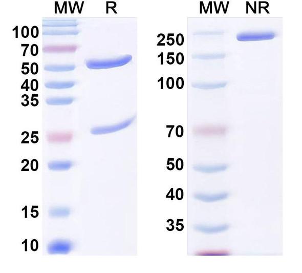 Anti-dsDNA/ssDNA Recombinant Monoclonal Antibody (A52) - SDS-PAGE