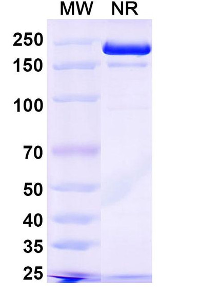 Anti-6, 4DNA/6-4PPs Recombinant Monoclonal Antibody (64M-2) - SDS-PAGE