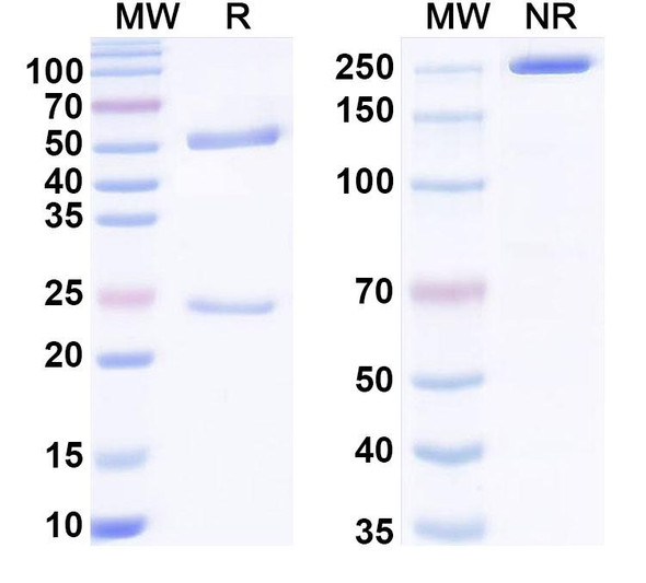 Anti-G-quadruplex DNA Recombinant Monoclonal Antibody (5E11#) - SDS-PAGE
