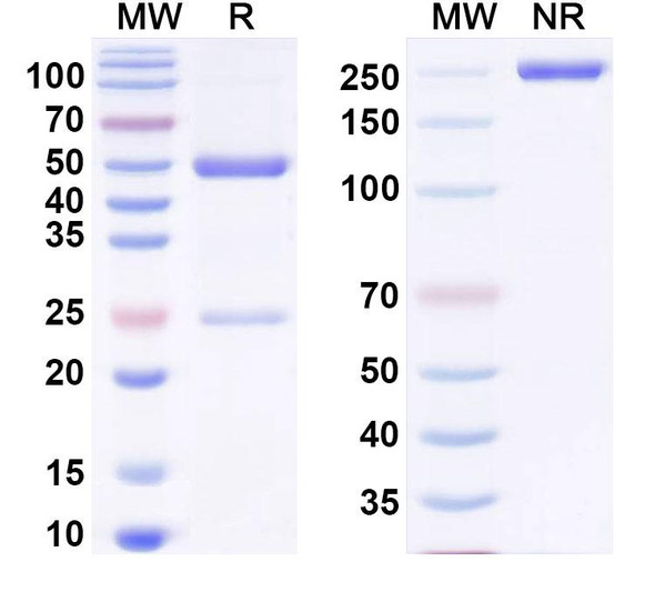 Anti-U1RNA Recombinant Monoclonal Antibody (R4) - SDS-PAGE