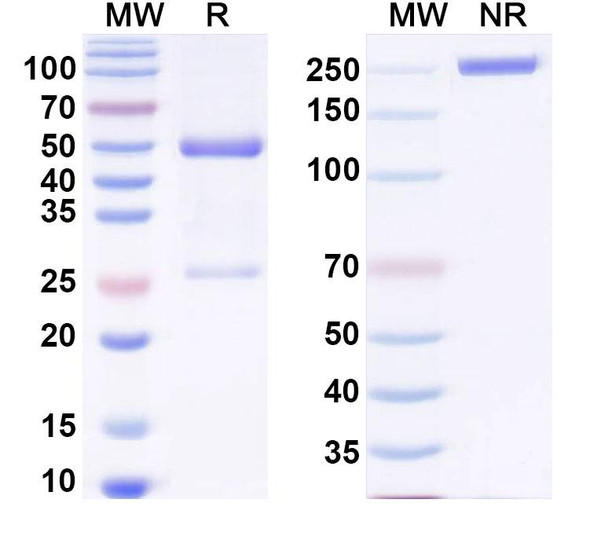 Anti-U1RNA Recombinant Monoclonal Antibody (Z5scFv7b) - SDS-PAGE