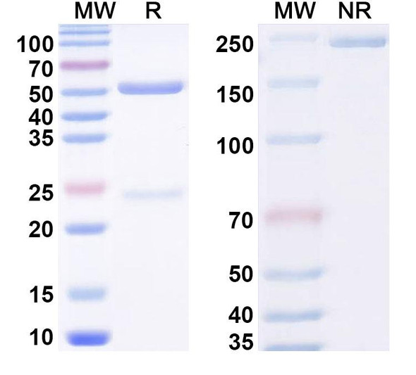 Anti-PEG Recombinant Monoclonal Antibody (E11.2#) - SDS-PAGE
