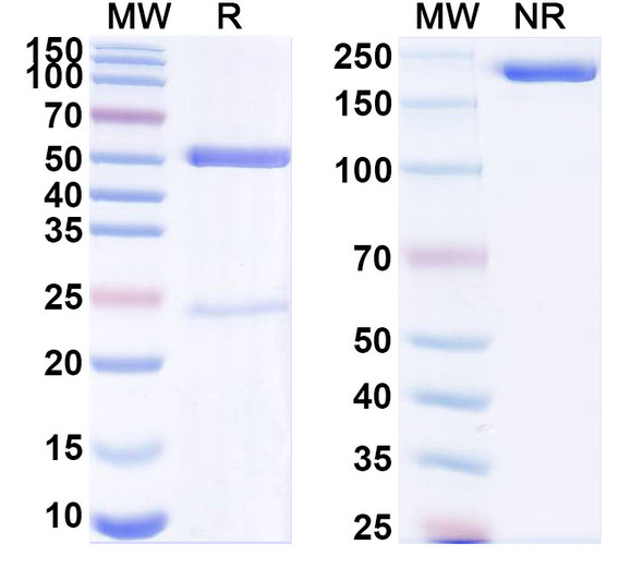 Anti-Mouse PCSK9 Recombinant Monoclonal Antibody (SAA0271) - SDS-PAGE