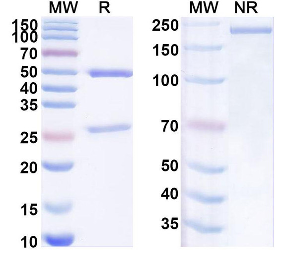 Anti-Mouse SOST Recombinant Monoclonal Antibody (SAA0272) - SDS-PAGE