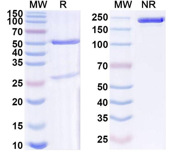 Anti-Mouse SERPINE1/PAI-1 Recombinant Monoclonal Antibody (SAA0768) - SDS-PAGE
