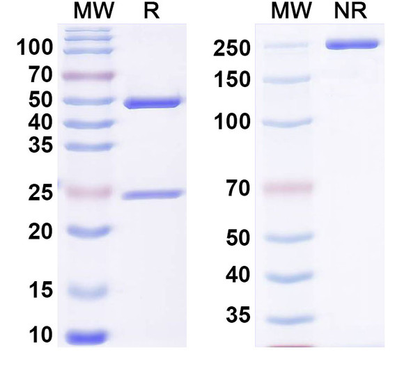 Anti-Mouse PLCG1 Recombinant Monoclonal Antibody (SAA0275) - SDS-PAGE