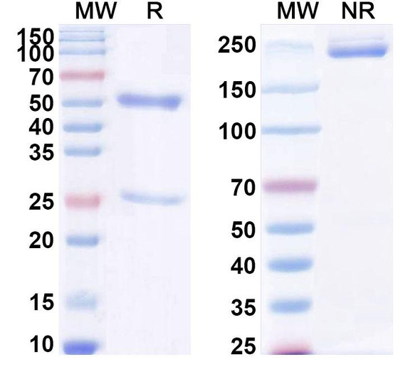 Anti-Human APOL1/Apolipoprotein L1, L2 Recombinant Monoclonal Antibody (3.6D12) - SDS-PAGE