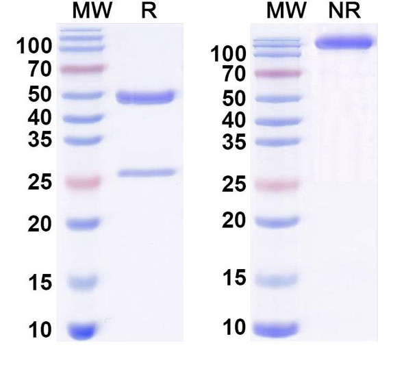Anti-Human VWF Recombinant Monoclonal Antibody (AJvW-2) - SDS-PAGE