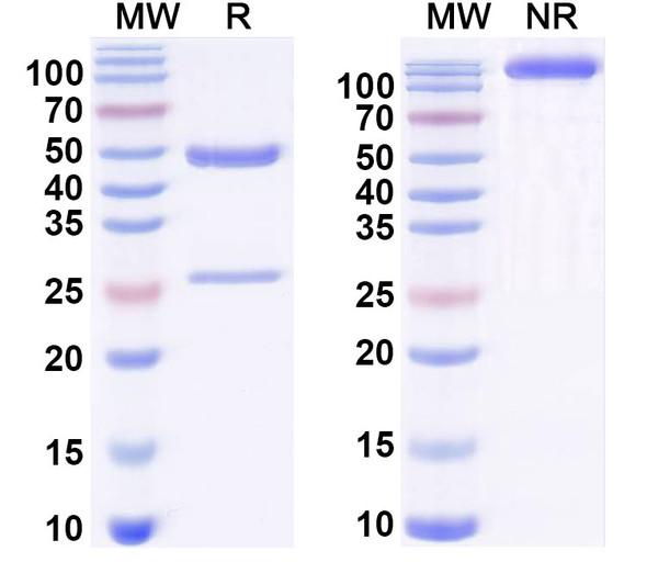 Anti-Human J1 epitope of COL2A1 Recombinant Monoclonal Antibody (M2139) - SDS-PAGE