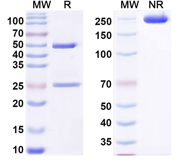 Anti-Human COL2A1 Recombinant Monoclonal Antibody (UL1) - SDS-PAGE