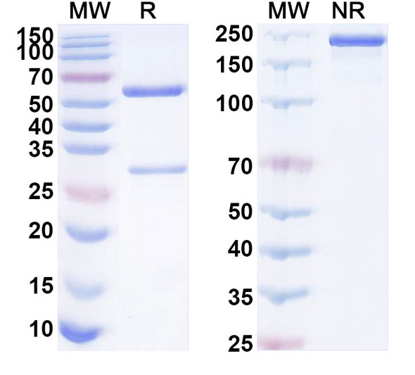 Anti-Human HLA-G Recombinant Monoclonal Antibody (15E7#) - SDS-PAGE