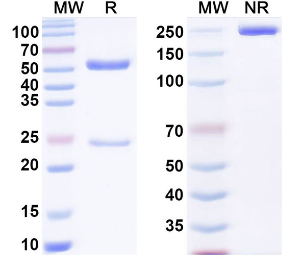 Anti-α-Gal Epitope (Galα1-3Galβ1-4GlcNAc-R) Recombinant Monoclonal Antibody (G9) - SDS-PAGE