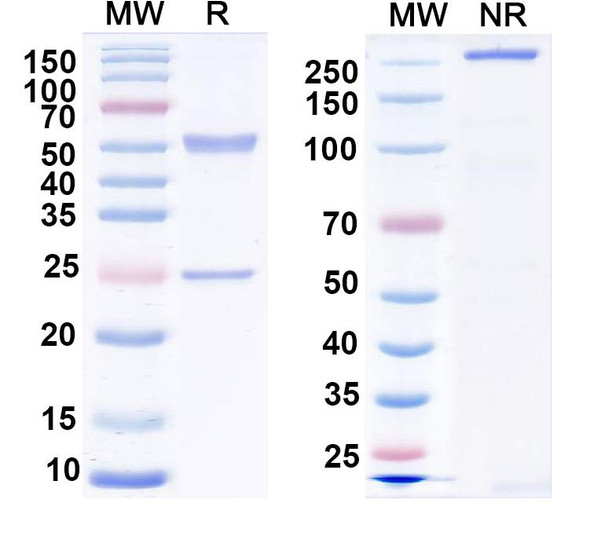 Anti-Vaccinia virus(VACV) H3L/Ag35 Recombinant Monoclonal Antibody (B9) - SDS-PAGE