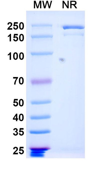 Anti-Vaccinia virus(VACV) L1R/Protein L1 Recombinant Monoclonal Antibody (7D11) - SDS-PAGE