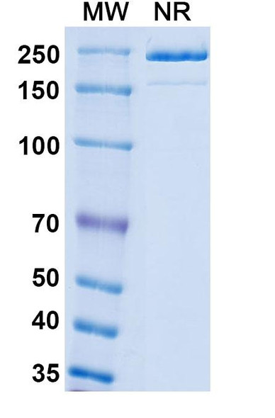Mouse Anti-Monkeypox virus/MPXV M1R Recombinant Monoclonal Antibody (SAA0284) - SDS-PAGE