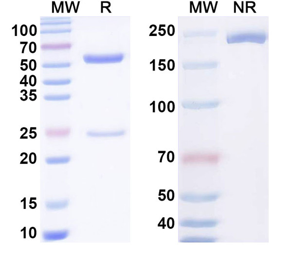 Anti-Mouse KIRREL3/NEPH2 Recombinant Monoclonal Antibody (N320/48) - SDS-PAGE