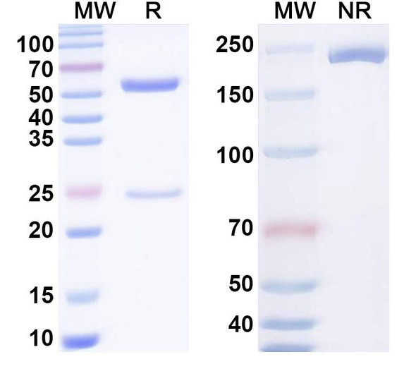 Anti-BVDV Envelope glycoprotein E2/gp55 Recombinant Monoclonal Antibody (H18) - SDS-PAGE