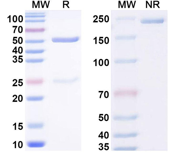 Anti-Phospho-RIPK3 (pS227) Recombinant Monoclonal Antibody (SAA0297) - SDS-PAGE