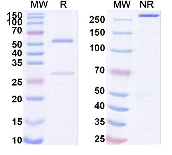 Anti-Phospho-RIPK3 (pS199) Recombinant Monoclonal Antibody (SAA0298) - SDS-PAGE