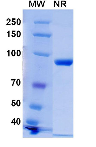 Anti-Phospho-γ-H2AX (pS139) Recombinant Monoclonal Antibody (C6) - SDS-PAGE