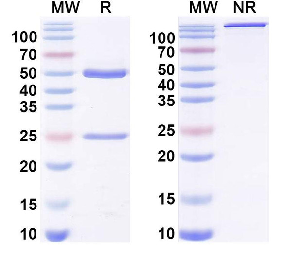 Anti-Phospho-γ-H2AX (pS139) Recombinant Monoclonal Antibody (A4) - SDS-PAGE