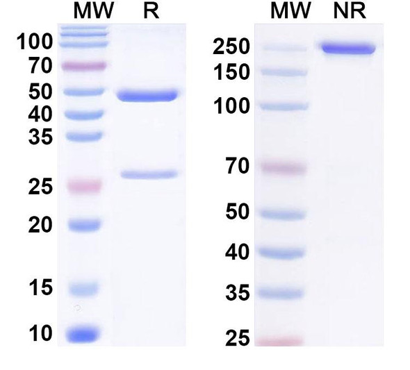 Anti-Phospho-AKT1 (pS473) Recombinant Monoclonal Antibody (SAA0300) - SDS-PAGE