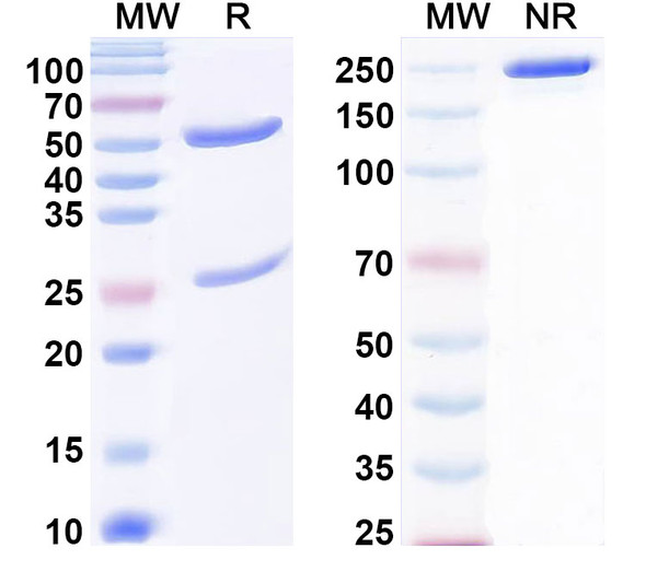 Anti-Phospho-CHK2 (pT68) Recombinant Monoclonal Antibody (34#) - SDS-PAGE