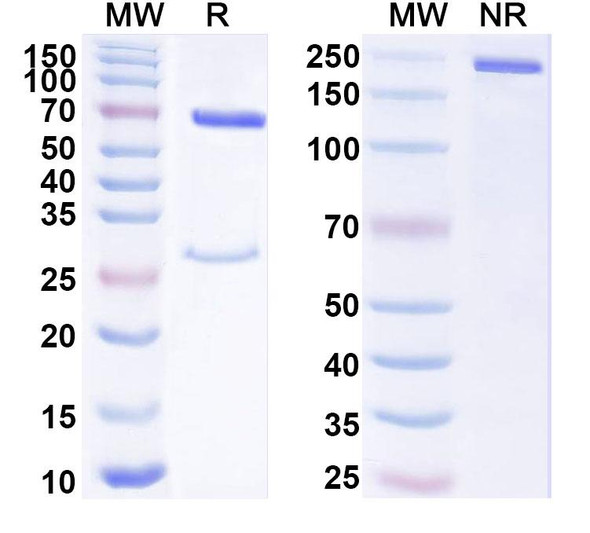 Anti-Phospho-CASC5 (pT943) Recombinant Monoclonal Antibody (pMELT-KNL1) - SDS-PAGE