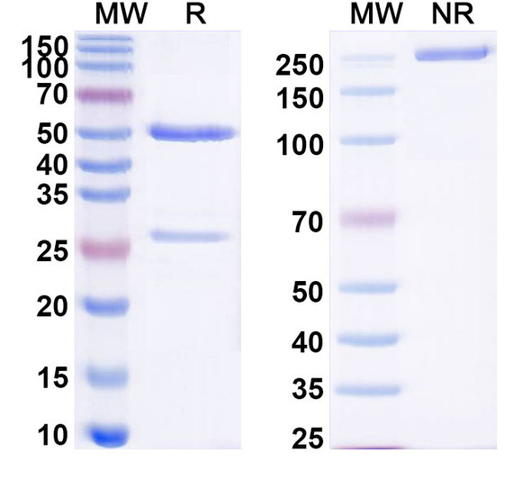 Anti-Pan-pY/pTyr/Phosphotyrosine Recombinant Monoclonal Antibody (PY20) - SDS-PAGE