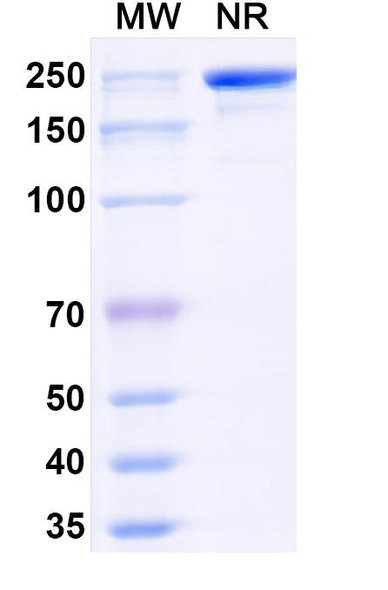 Anti-Pan-pS/pSer/Phosphoserine Recombinant Monoclonal Antibody (SAA0307) - SDS-PAGE