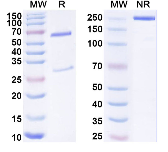 Anti-Human TSLPR/CRLF2 Recombinant Monoclonal Antibody (13H5) - SDS-PAGE