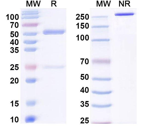 Anti-Human SLC6A4/SERT Recombinant Monoclonal Antibody (15B8) - SDS-PAGE