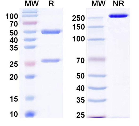 Anti-Plasmodium falciparum MSA2/MSP2 Recombinant Monoclonal Antibody (4D11) - SDS-PAGE